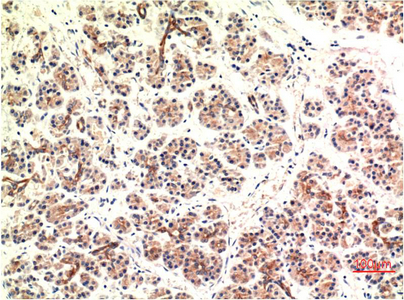 Mouse anti-DDIT3 Monoclonal Antibody(7G7)