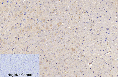 Mouse anti-MAP2 Monoclonal Antibody(3B5)