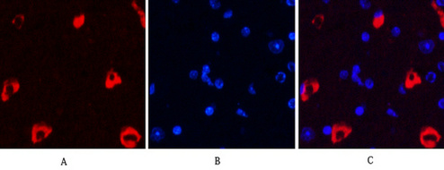 Mouse anti-MAP2 Monoclonal Antibody(3B5)