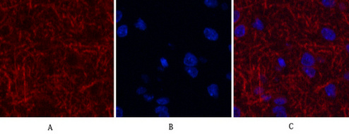 Mouse anti-MAP2 Monoclonal Antibody(3B5)