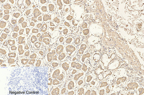Mouse anti-CD4 Monoclonal Antibody(7H9)