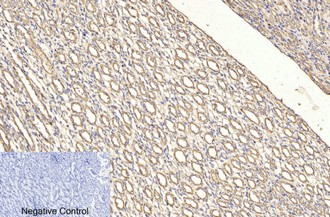 Mouse anti-CD4 Monoclonal Antibody(7H9)