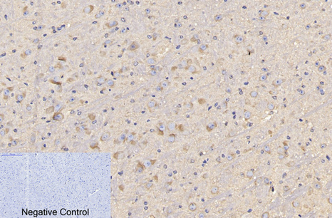 Mouse anti-CD4 Monoclonal Antibody(7H9)