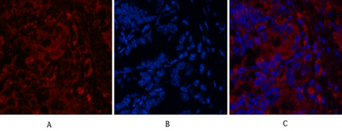 Mouse anti-CD4 Monoclonal Antibody(7H9)