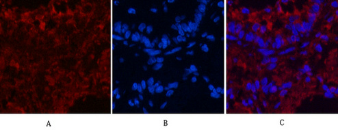 Mouse anti-CD4 Monoclonal Antibody(7H9)