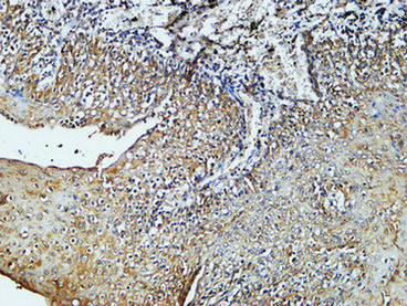 Mouse anti-CD4 Monoclonal Antibody(7H9)