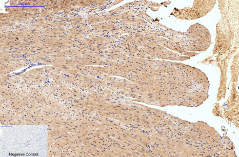 Mouse anti-Hydroxyacid Oxidase 1 Monoclonal Antibody(4B4)