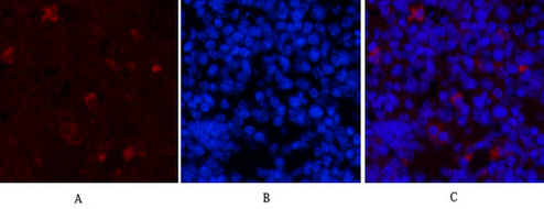 Mouse anti-Hydroxyacid Oxidase 1 Monoclonal Antibody(4B4)