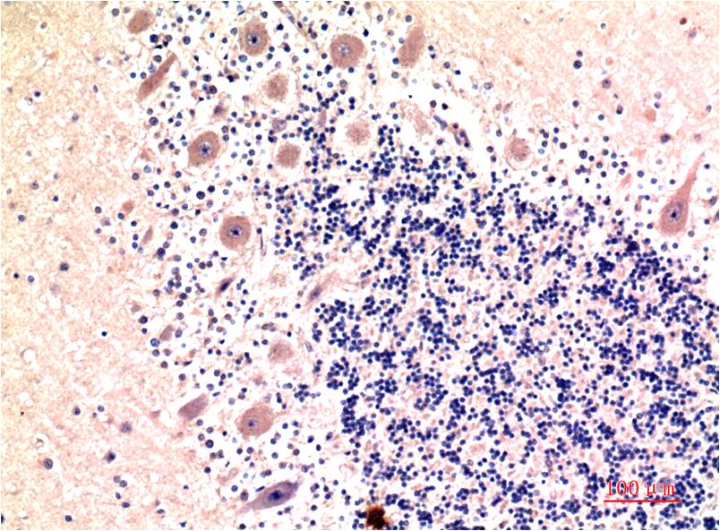 Mouse anti-LC3B Monoclonal Antibody(8H6)
