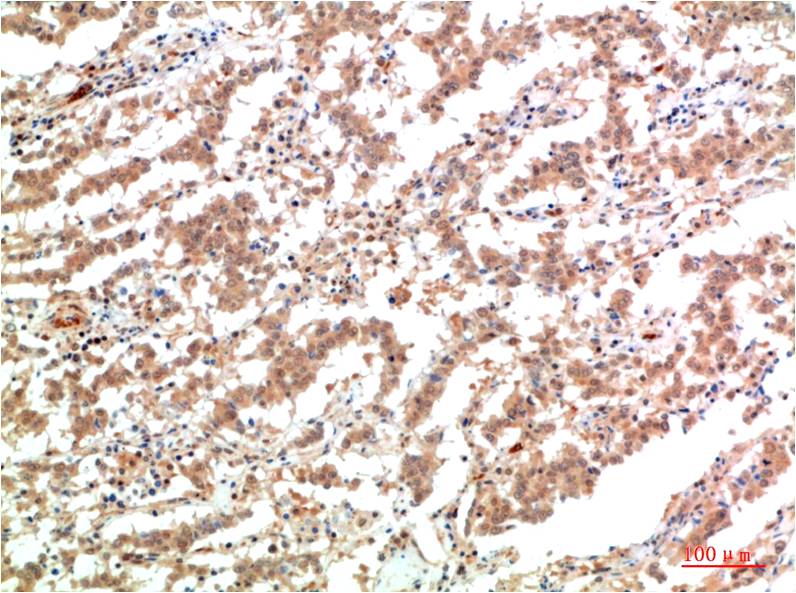 Mouse anti-JAK2 Monoclonal Antibody(7H5)