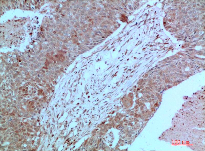 Mouse anti-JAK2 Monoclonal Antibody(7H5)