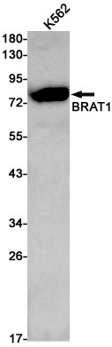 Rabbit anti-BRAT1 Monoclonal Antibody(4D9)