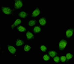 Mouse anti-TBL1X Monoclonal Antibody(4H2)