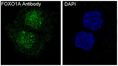 Rabbit anti-FOXO1 Polyclonal Antibody