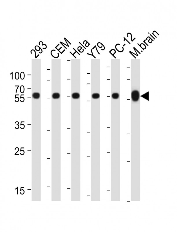 Mouse anti-TBB5 Monoclonal Antibody(87CT59.3.7)