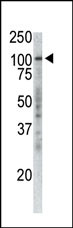 Mouse anti-P100 Monoclonal Antibody(19AT738.292)