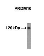 Mouse anti-PRDM10 Monoclonal Antibody(48AT1224.90.46)
