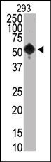 Mouse anti-SET07 Monoclonal Antibody(43AT890)