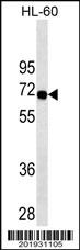 Mouse anti-SWAP70 Monoclonal Antibody(434CT16.5.5)