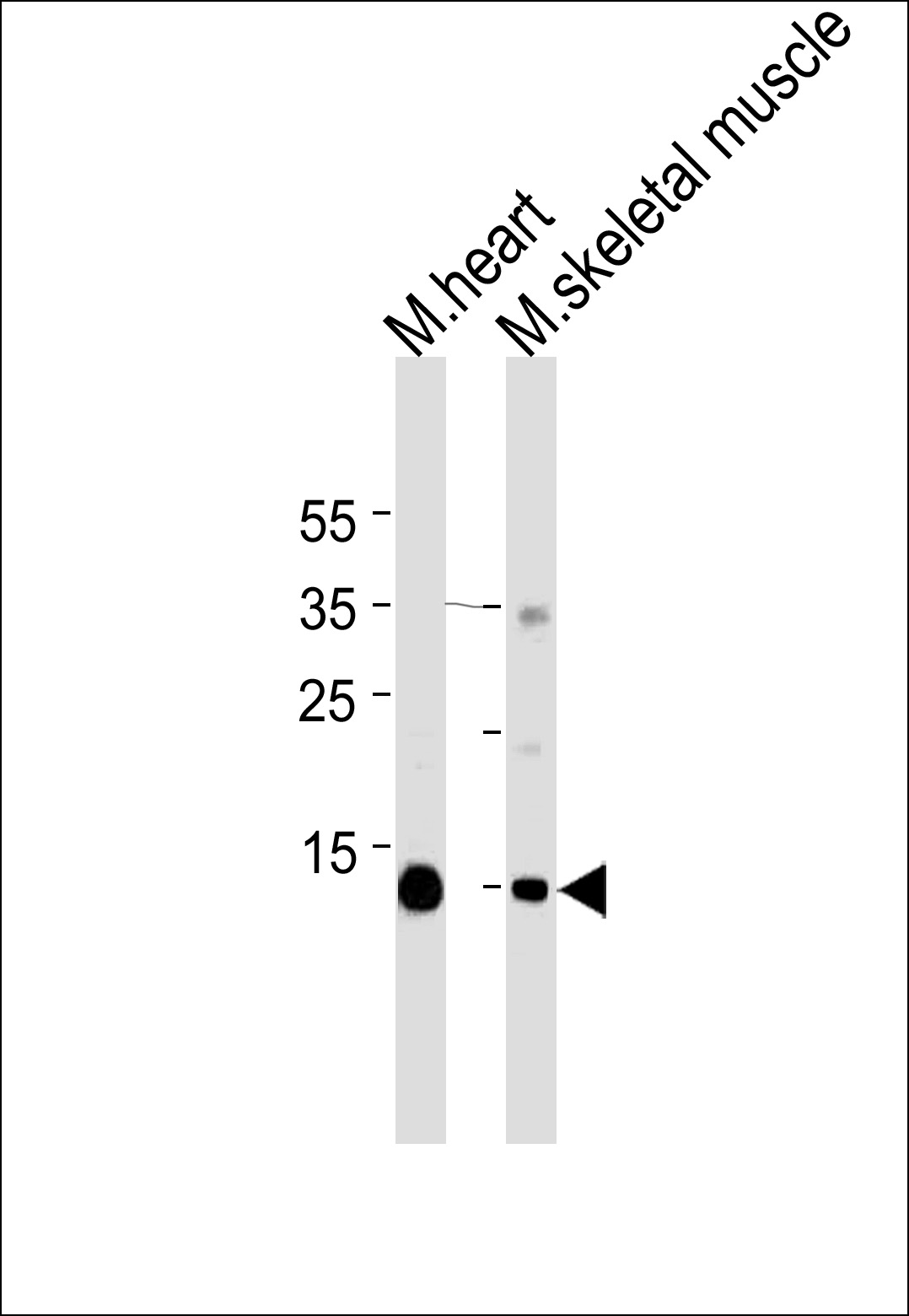 Mouse anti-Myoglobin Monoclonal Antibody(444CT19.2.1)