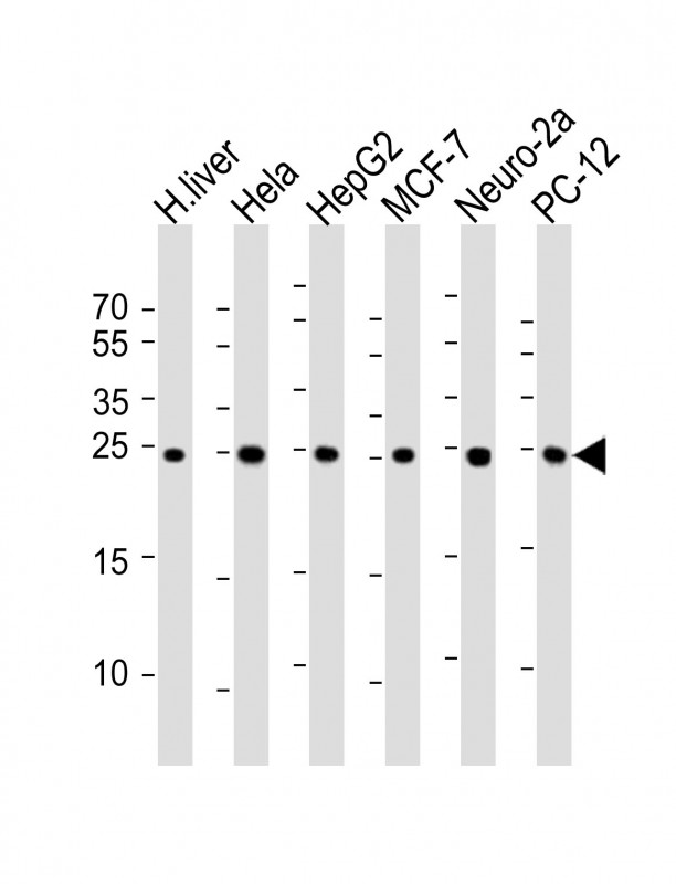Mouse anti-PSMA5 Monoclonal Antibody(426CT8.5.1)