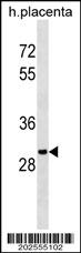 Mouse anti-OR5B12 Monoclonal Antibody(C-term)(609CT8.2.4)