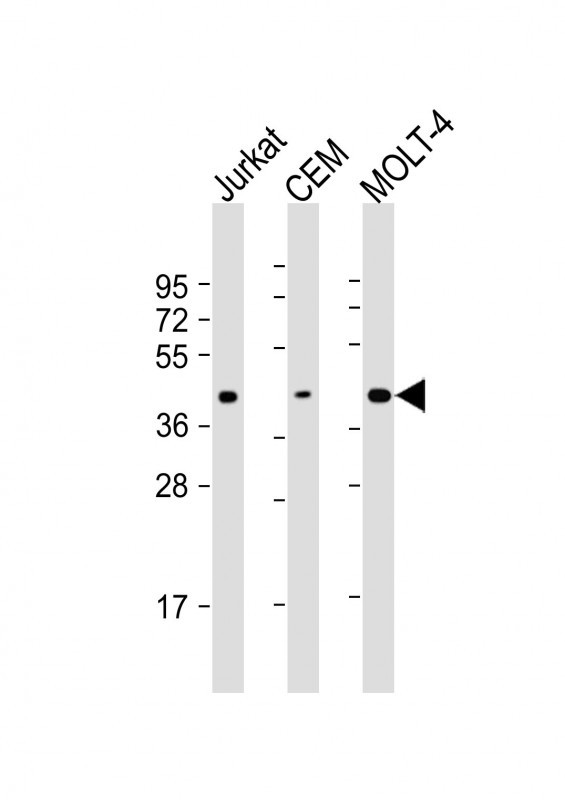Mouse anti-ADA Monoclonal Antibody(C-term)(608CT2.1.3)