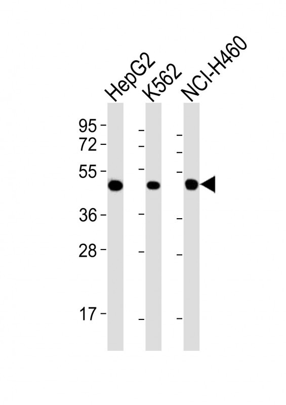 Mouse anti-CYK18 Monoclonal Antibody(C-term) (608CT2.1.3)