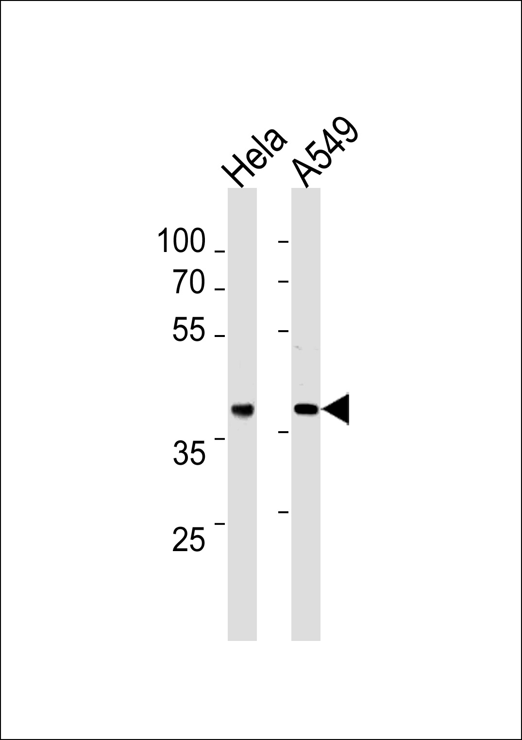 Mouse anti-ERCC1 Monoclonal Antibody(C-term) (752CT13.2.5)