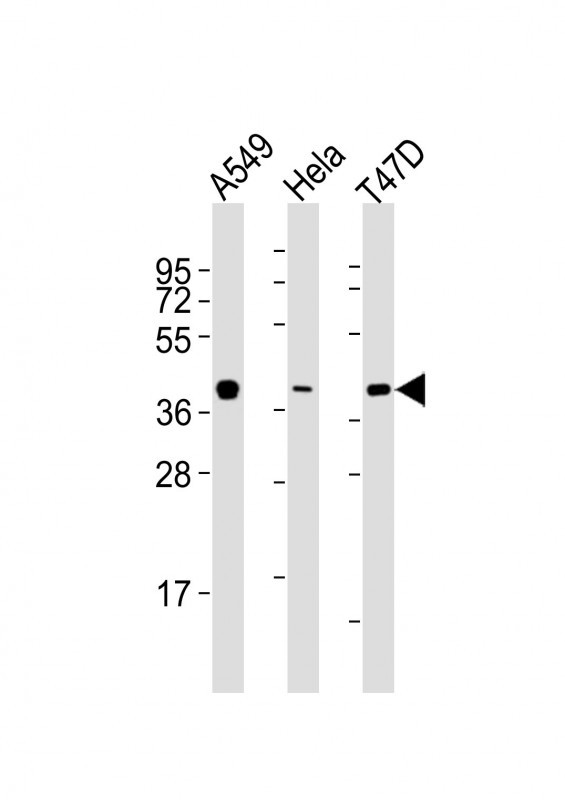 Mouse anti-ERCC1 Monoclonal Antibody(C-term) (752CT13.2.5)