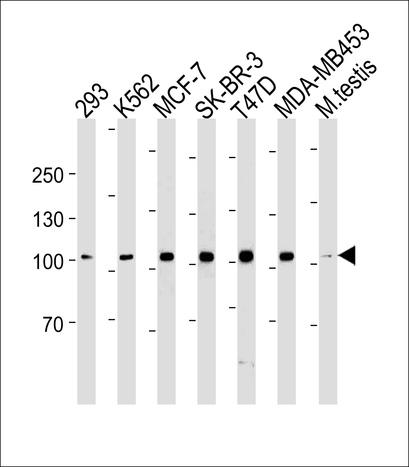 Mouse anti-ACE2 Monoclonal Antibody(881CT16.4.4)
