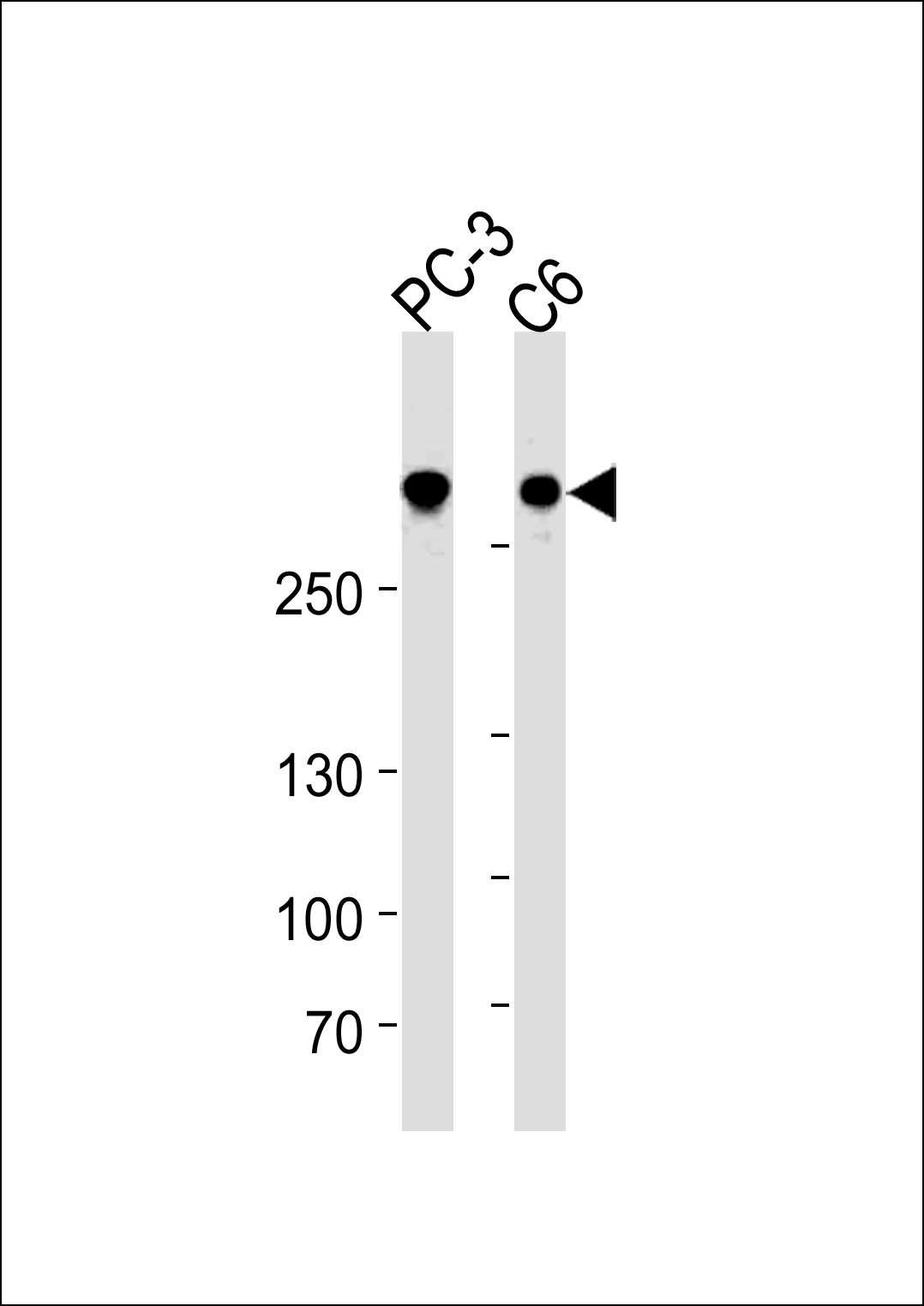Mouse anti-FLNA Monoclonal Antibody(1273CT424.104.153)