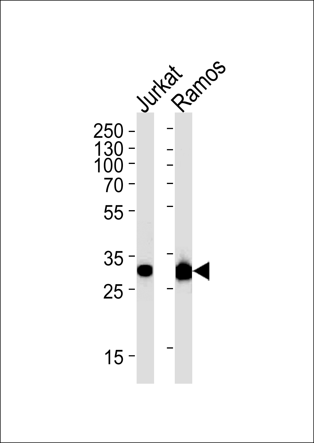 Mouse anti-CASP3 Monoclonal Antibody(1262CT521.280.101)