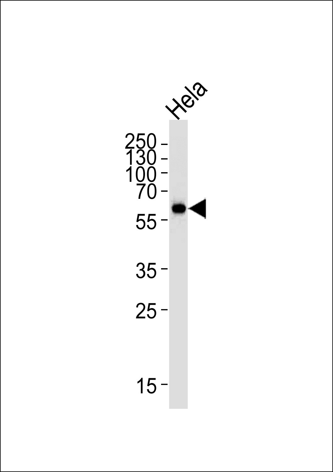 Mouse anti-HDAC2 Monoclonal Antibody(Center)(1194CT18.5.1)
