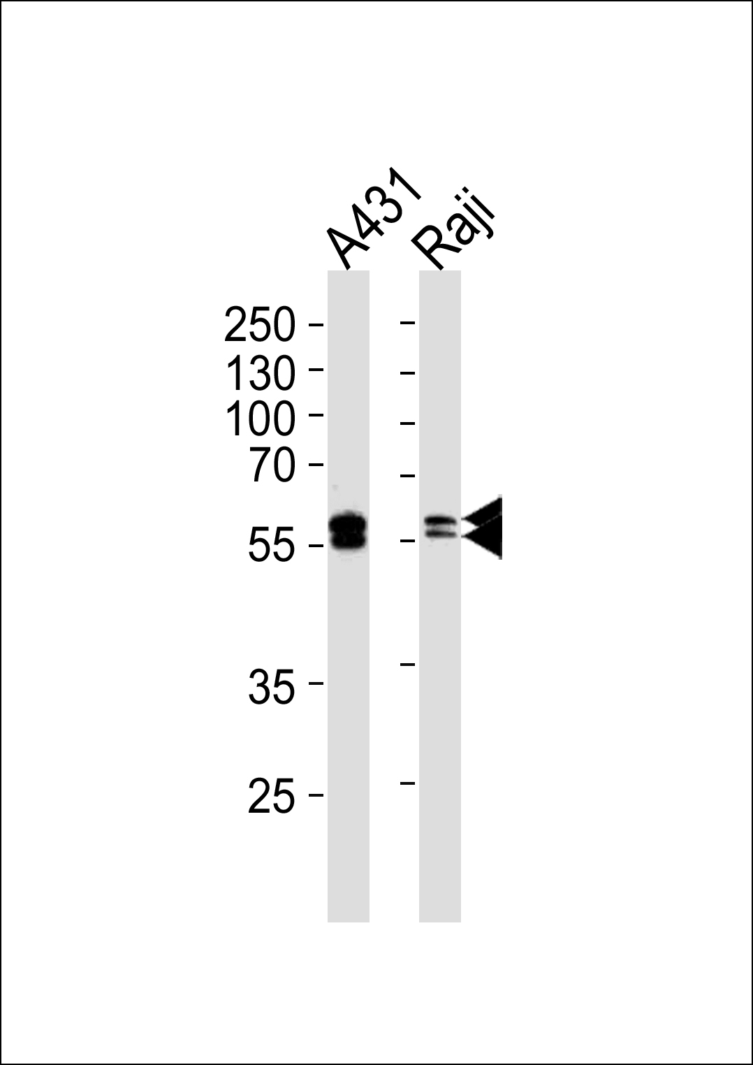 Mouse anti-LYN Monoclonal Antibody(1174CT22.3.1.1)