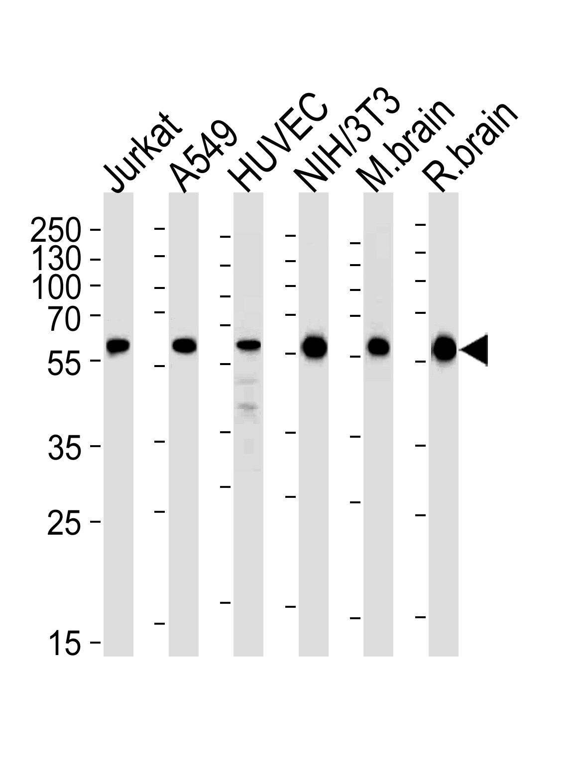 Mouse anti-RAD23B Monoclonal Antibody(N-term)(1228CT409.120.123.135)