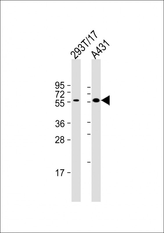 Mouse anti-PINK1 Monoclonal Antibody(38CT20.8.5)
