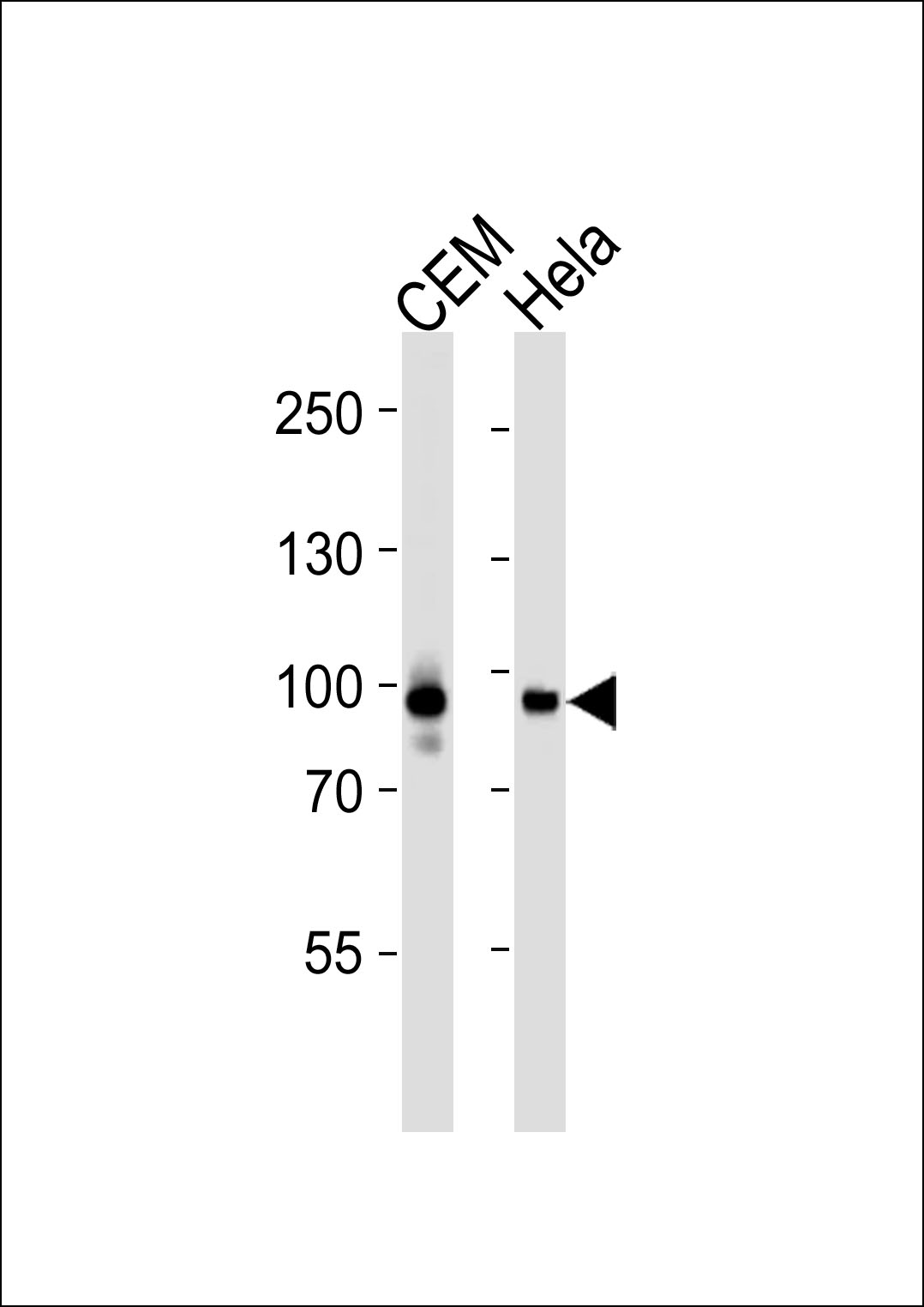 Mouse anti-STAT3 Monoclonal Antibody(1200CT146.104.153)
