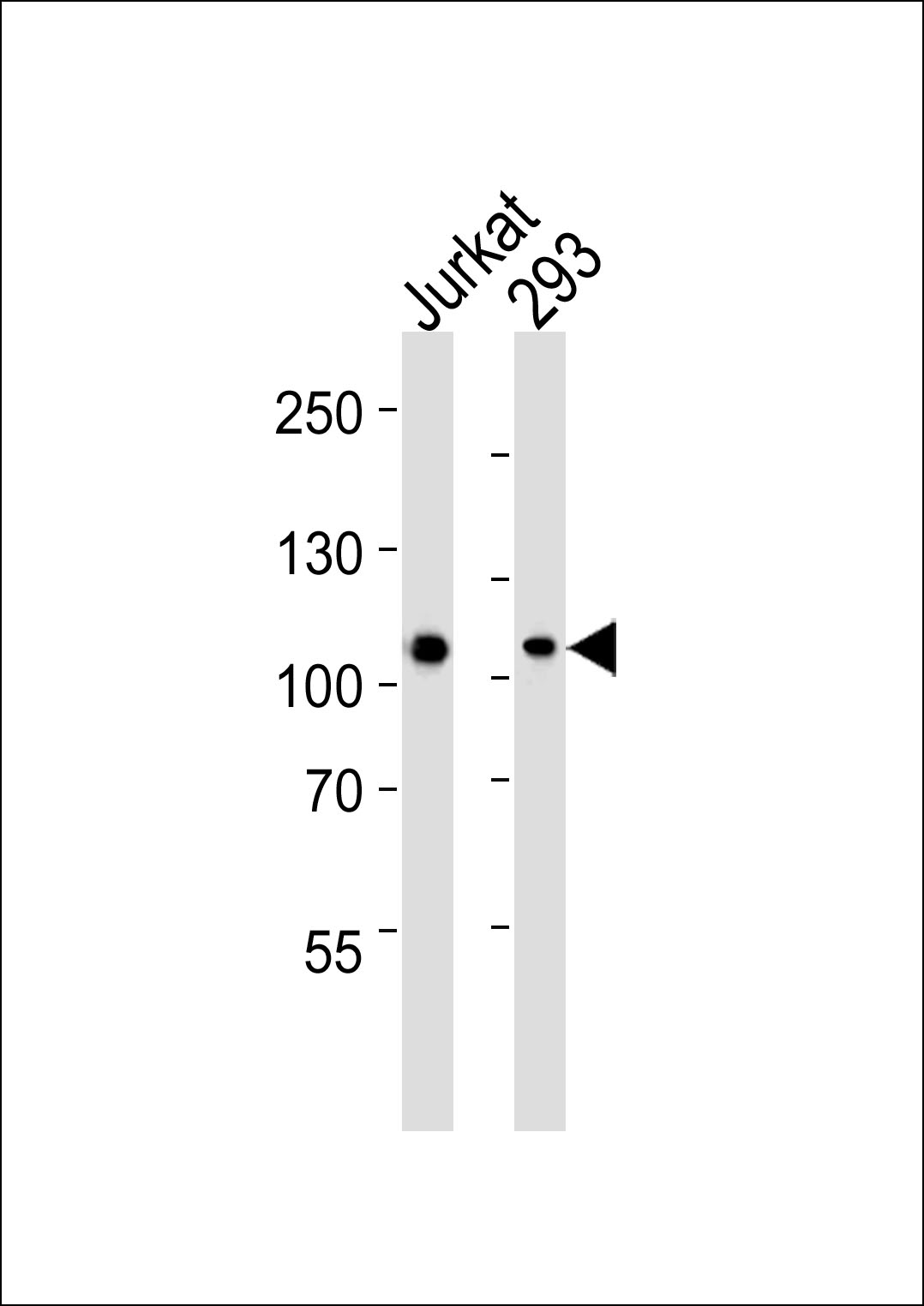 Mouse anti-MAGED1 Monoclonal Antibody(Center)(1305CT862.157.127)