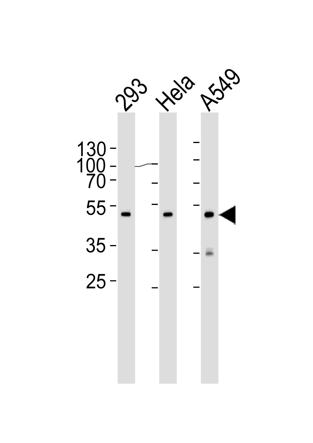 Mouse anti-CBX8 Monoclonal Antibody(C-term)(1214CT171.154.107)