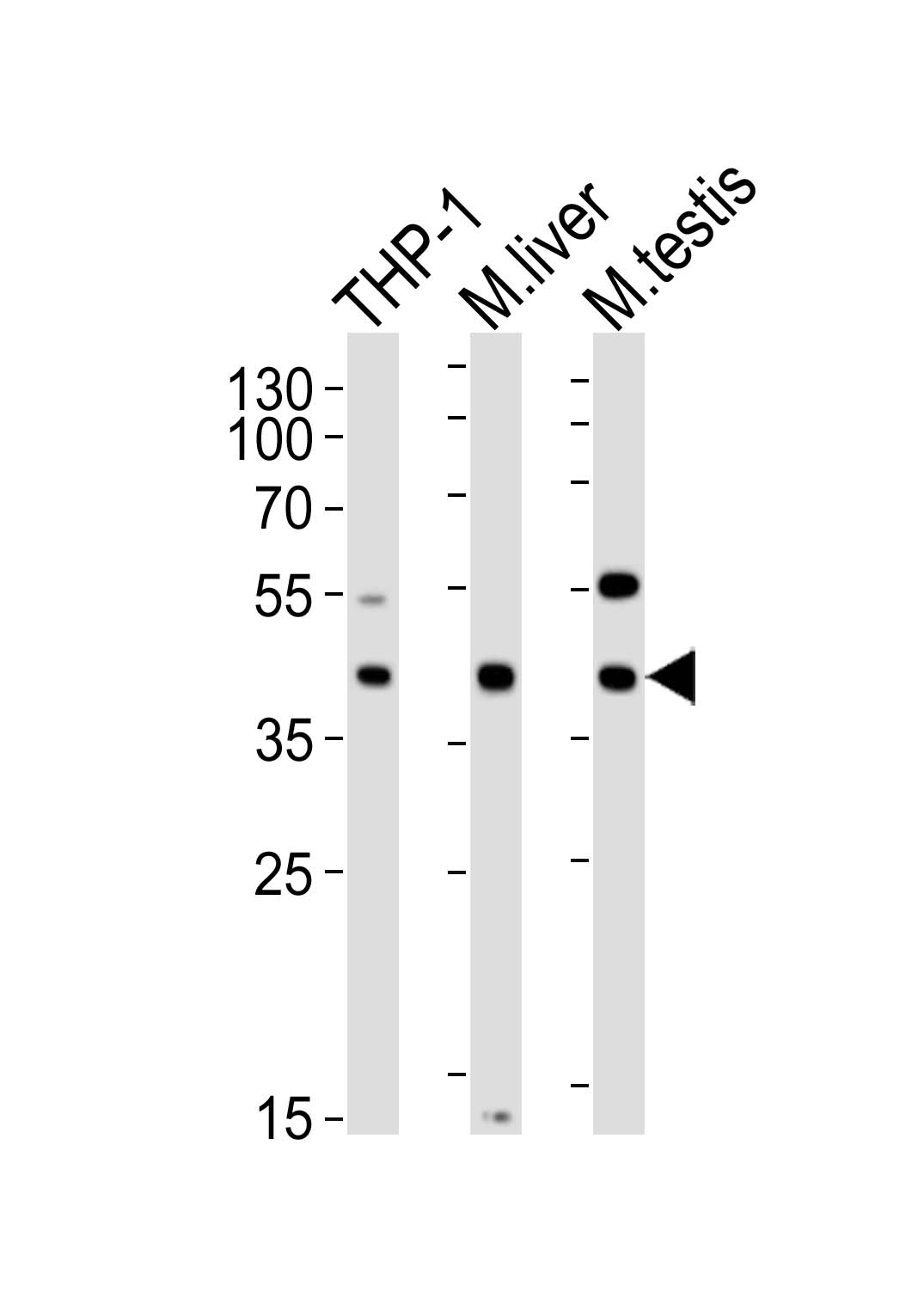 Mouse anti-ATG3 Monoclonal Antibody(1377CT239.6.1.12)