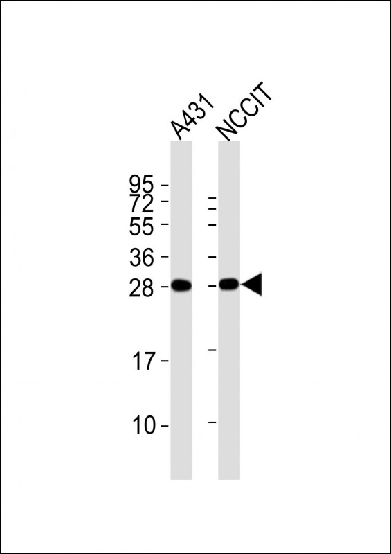 Mouse anti-BAP31 Monoclonal Antibody(1502CT208.31.16)