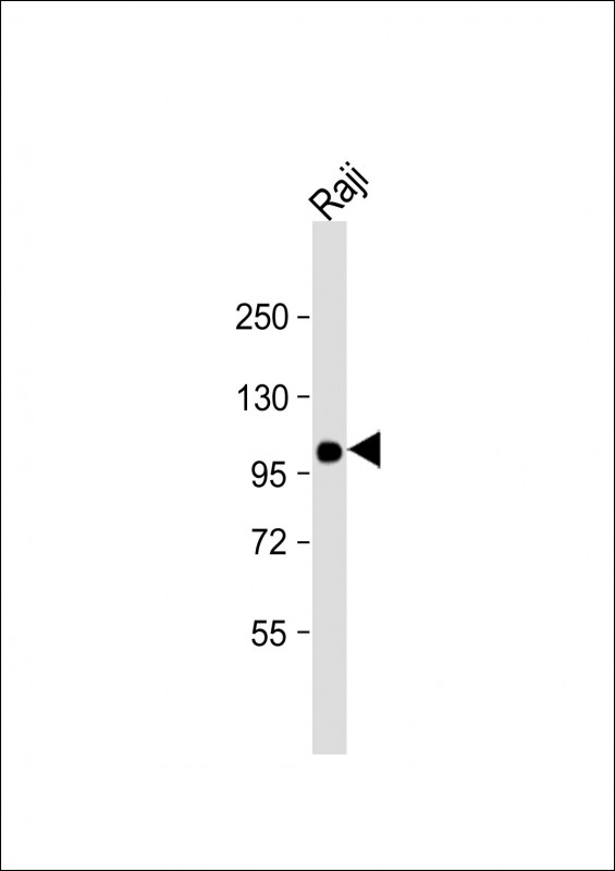 Mouse anti-VAV1 Monoclonal Antibody(1582CT802.383.58)
