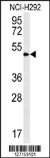 Rabbit anti-ZNF154 Polyclonal Antibody(N-term)