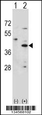 Rabbit anti-HSD3B1 Polyclonal Antibody(N-term)