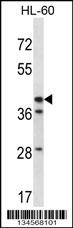 Rabbit anti-HSD3B1 Polyclonal Antibody(N-term)