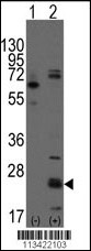 Rabbit anti-CD9 Polyclonal Antibody(N-term)