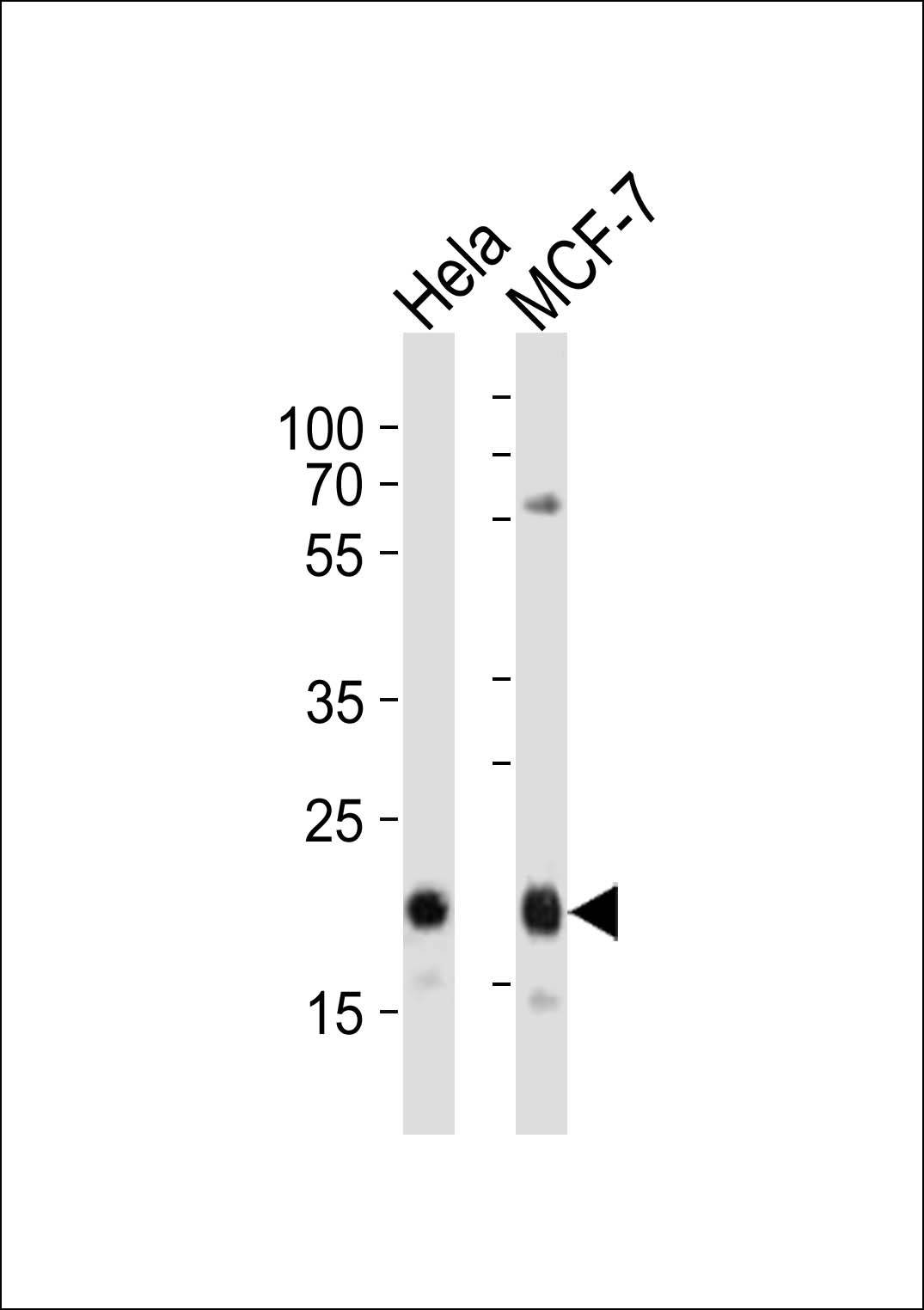 Rabbit anti-CD9 Polyclonal Antibody(Center)
