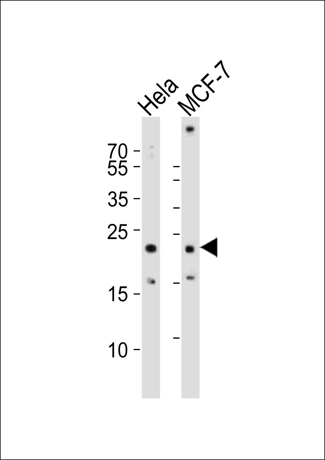 Rabbit anti-CD9 Polyclonal Antibody(Center)