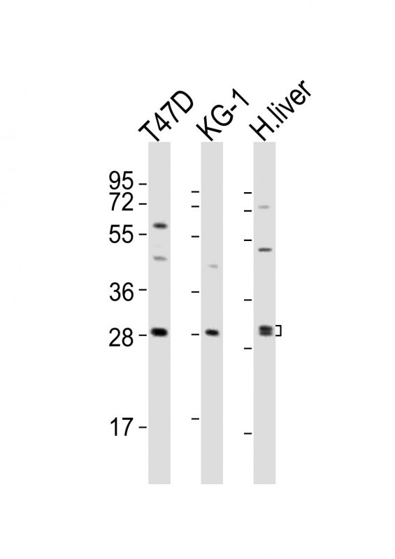 Rabbit anti-HAVCR2 Polyclonal Antibody(Center)